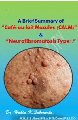 eBook cover showing Café-au-lait macules and their link to NF1 diagnosis