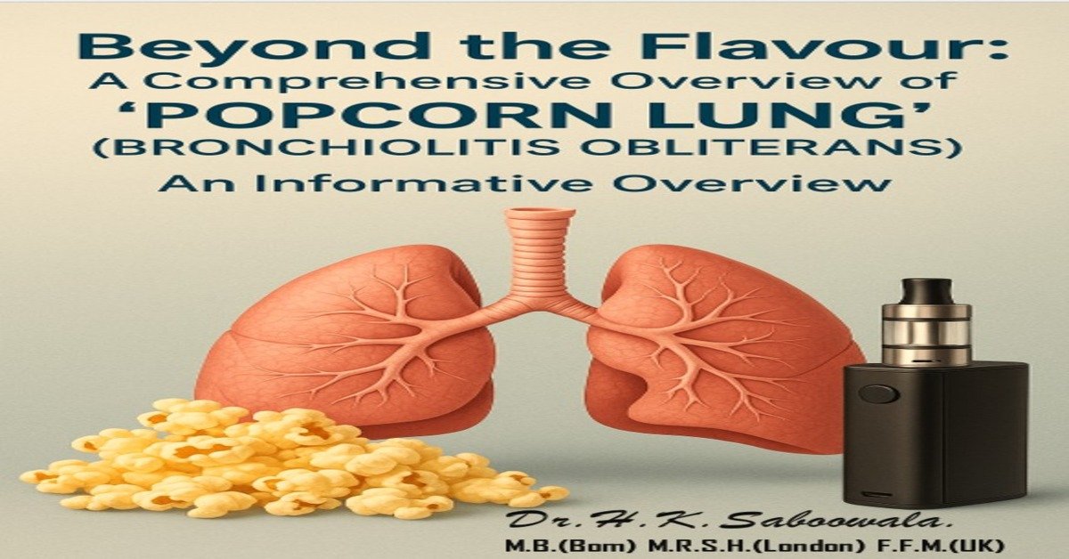 Popcorn Lung (Bronchiolitis Obliterans) – causes and treatment overview